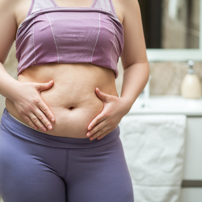 κοιλια μετα απο καισαρικη τομη